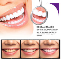 V34 Whitening Tooth Cleaning Mousse – Stain Removal & Gum Care