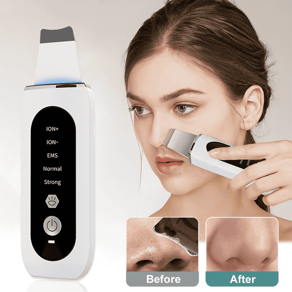 Ultrasonic Blackhead Remover & Skin Rejuvenation