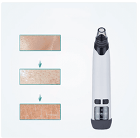 Blackhead Remover Vacuum