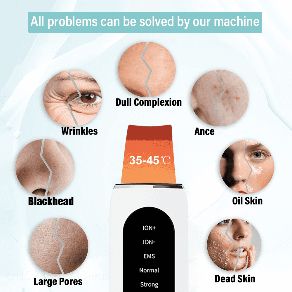 Ultrasonic Blackhead Remover & Skin Rejuvenation