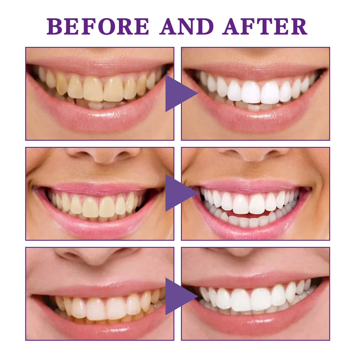 V34 Whitening Tooth Cleaning Mousse – Stain Removal & Gum Care