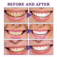 V34 Whitening Tooth Cleaning Mousse – Stain Removal & Gum Care