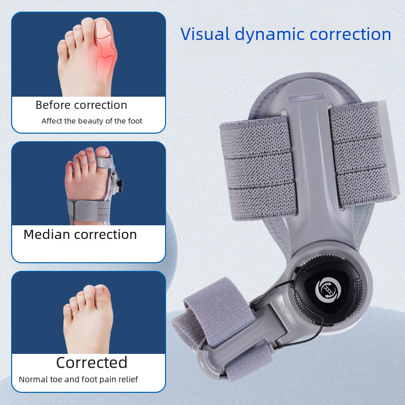 Adjustable Bunion Corrector – Ergonomic Toe Separator for Men & Women